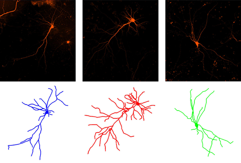 Research figure displaying varying dendritic branching levels.